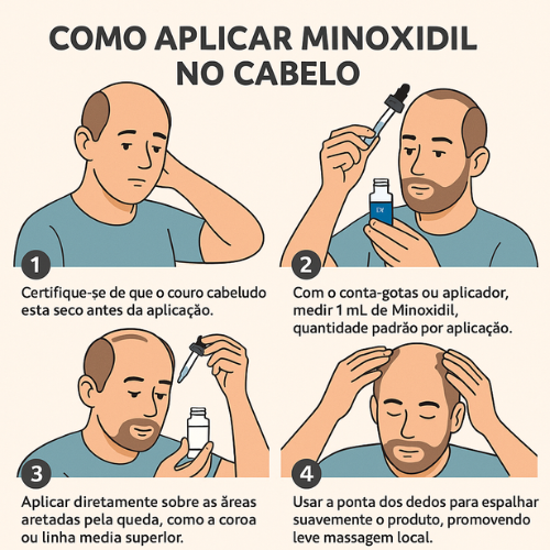 Como usar minoxidil no cabelo